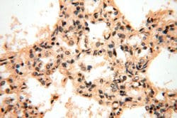 VAC14 Rabbit anti-Human, Mouse, Rat, Polyclonal, Proteintech 150 &mu;L;