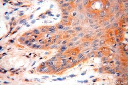 VAC14 Rabbit anti-Human, Mouse, Rat, Polyclonal, Proteintech 150 &mu;L;