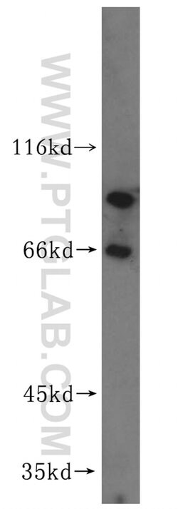 VAC14 Rabbit anti-Human, Mouse, Rat, Polyclonal, Proteintech 150 &mu;L;