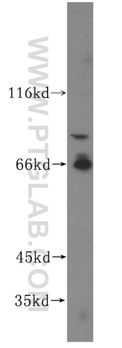 VAC14 Rabbit anti-Human, Mouse, Rat, Polyclonal, Proteintech 150 &mu;L;