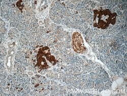 RAB3B Rabbit anti-Human, Mouse, Rat, Polyclonal, Proteintech:Antibodies:Primary