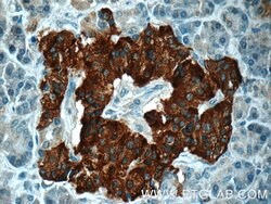 RAB3B Rabbit anti-Human, Mouse, Rat, Polyclonal, Proteintech:Antibodies:Primary