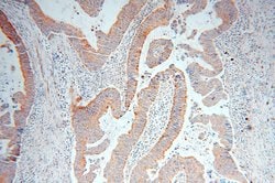 RAB3B Rabbit anti-Human, Mouse, Rat, Polyclonal, Proteintech:Antibodies:Primary