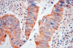 RAB3B Rabbit anti-Human, Mouse, Rat, Polyclonal, Proteintech:Antibodies:Primary