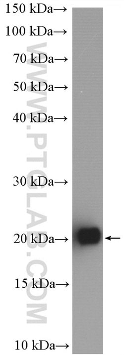 RAB3B Rabbit anti-Human, Mouse, Rat, Polyclonal, Proteintech:Antibodies:Primary