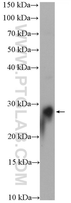 RAB3B Rabbit anti-Human, Mouse, Rat, Polyclonal, Proteintech:Antibodies:Primary