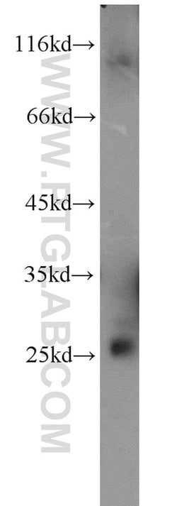 RAB3B Rabbit anti-Human, Mouse, Rat, Polyclonal, Proteintech:Antibodies:Primary
