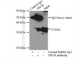 TBCB Rabbit anti-Human, Mouse, Rat, Polyclonal, Proteintech 150 &mu;L;