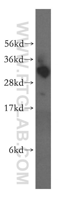 TBCB Rabbit anti-Human, Mouse, Rat, Polyclonal, Proteintech 150 &mu;L;