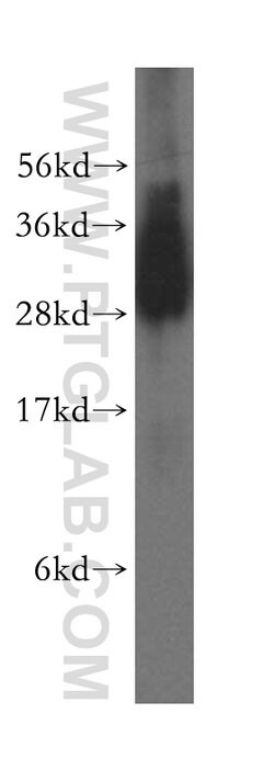TBCB Rabbit anti-Human, Mouse, Rat, Polyclonal, Proteintech 150 &mu;L;