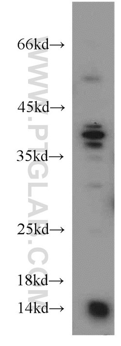 PIN4 Rabbit anti-Human, Mouse, Rat, Polyclonal, Proteintech 20 &mu;L; Unconjugated:Antibodies,