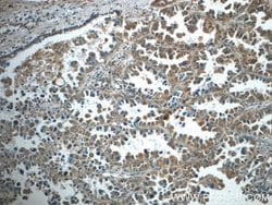 TNFAIP8 Rabbit anti-Human, Mouse, Rat, Polyclonal, Proteintech 150 &mu;L;