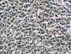 TNFAIP8 Rabbit anti-Human, Mouse, Rat, Polyclonal, Proteintech 150 &mu;L;