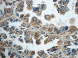 TNFAIP8 Rabbit anti-Human, Mouse, Rat, Polyclonal, Proteintech 150 &mu;L;