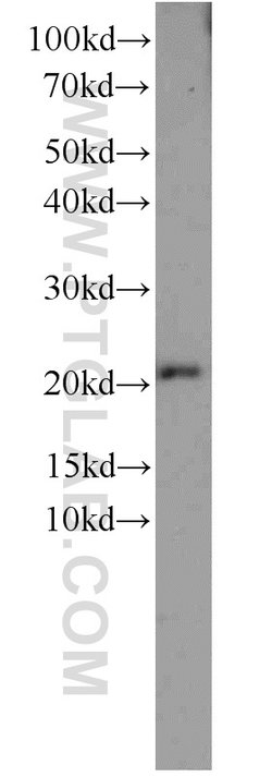 TNFAIP8 Rabbit anti-Human, Mouse, Rat, Polyclonal, Proteintech 150 &mu;L;