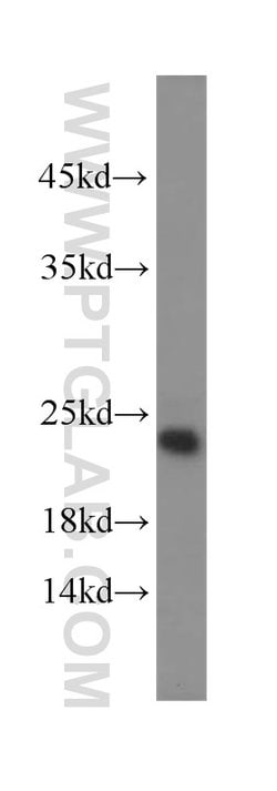 TNFAIP8 Rabbit anti-Human, Mouse, Rat, Polyclonal, Proteintech 150 &mu;L;