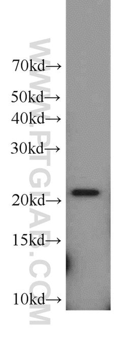 TNFAIP8 Rabbit anti-Human, Mouse, Rat, Polyclonal, Proteintech 150 &mu;L;