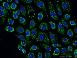 LRCH3 Rabbit anti-Human, Mouse, Rat, Polyclonal, Proteintech 150 &mu;L;