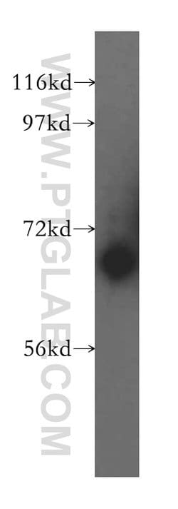 LRCH3 Rabbit anti-Human, Mouse, Rat, Polyclonal, Proteintech 150 &mu;L;