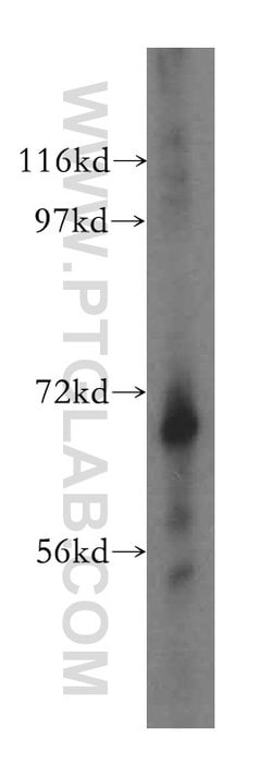 LRCH3 Rabbit anti-Human, Mouse, Rat, Polyclonal, Proteintech 150 &mu;L;