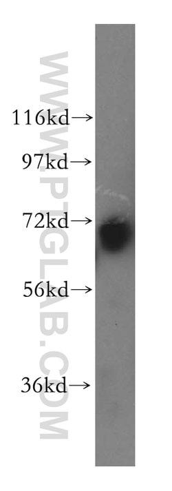 LRCH3 Rabbit anti-Human, Mouse, Rat, Polyclonal, Proteintech 150 &mu;L;