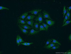 GRIPAP1 Rabbit anti-Human, Mouse, Rat, Polyclonal, Proteintech