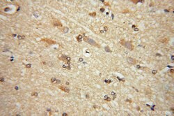 GRIPAP1 Rabbit anti-Human, Mouse, Rat, Polyclonal, Proteintech:Antibodies:Primary