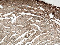 Alpha B Crystallin Rabbit anti-Human, Mouse, Rat, Polyclonal, Proteintech:Antibodies:Primary