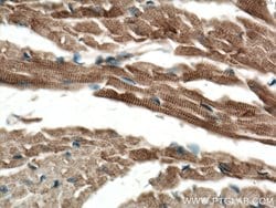 Alpha B Crystallin Rabbit anti-Human, Mouse, Rat, Polyclonal, Proteintech:Antibodies:Primary