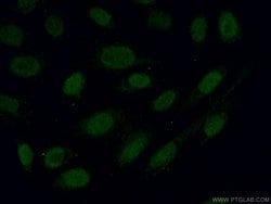 Alpha B Crystallin Rabbit anti-Human, Mouse, Rat, Polyclonal, Proteintech:Antibodies:Primary