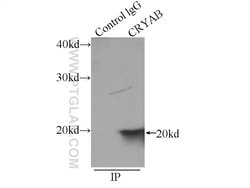 Alpha B Crystallin Rabbit anti-Human, Mouse, Rat, Polyclonal, Proteintech:Antibodies:Primary