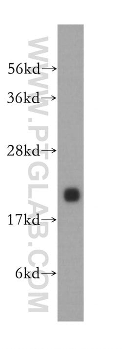Alpha B Crystallin Rabbit anti-Human, Mouse, Rat, Polyclonal, Proteintech:Antibodies:Primary