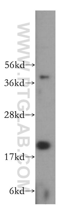 Centrin 3 Rabbit anti-Human, Mouse, Rat, Polyclonal, Proteintech:Antibodies:Primary