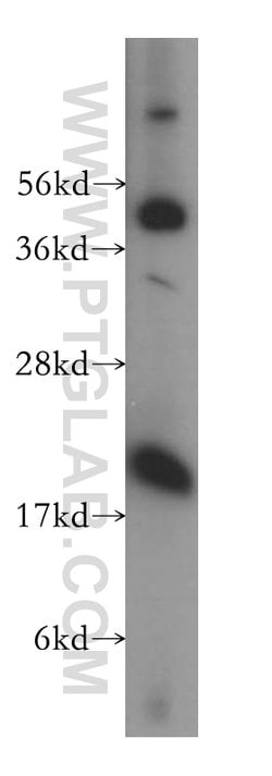 Centrin 3 Rabbit anti-Human, Mouse, Rat, Polyclonal, Proteintech:Antibodies:Primary