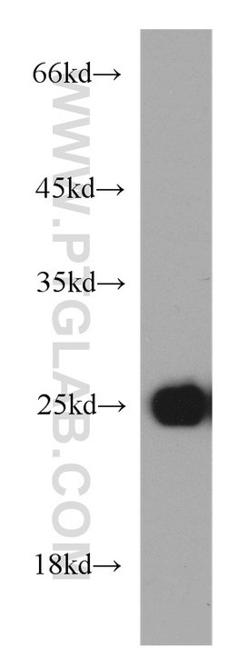 MYL1 Rabbit anti-Human, Mouse, Rat, Polyclonal, Proteintech 150 &mu;L;