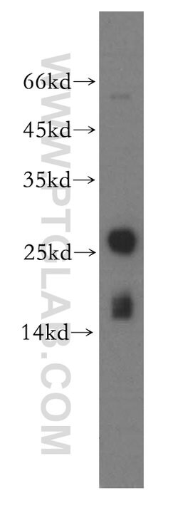 MYL1 Rabbit anti-Human, Mouse, Rat, Polyclonal, Proteintech 150 &mu;L;