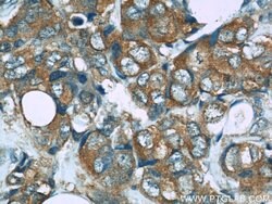 PRDX1 Rabbit anti-Human, Mouse, Rat, Polyclonal, Proteintech 150 &mu;L;