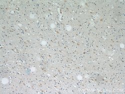 PRDX1 Rabbit anti-Human, Mouse, Rat, Polyclonal, Proteintech 150 &mu;L;