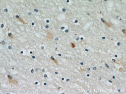 PRDX1 Rabbit anti-Human, Mouse, Rat, Polyclonal, Proteintech 150 &mu;L;
