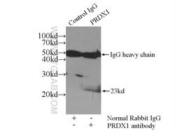 PRDX1 Rabbit anti-Human, Mouse, Rat, Polyclonal, Proteintech 150 &mu;L;
