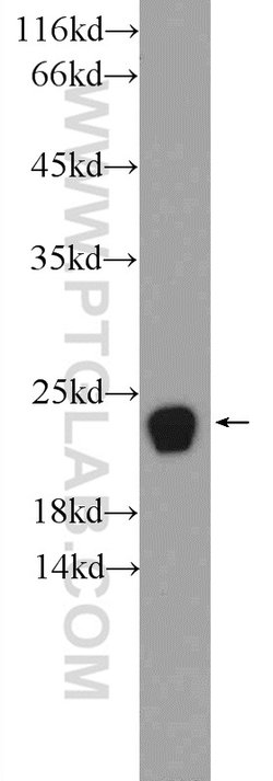 PRDX1 Rabbit anti-Human, Mouse, Rat, Polyclonal, Proteintech 150 &mu;L;