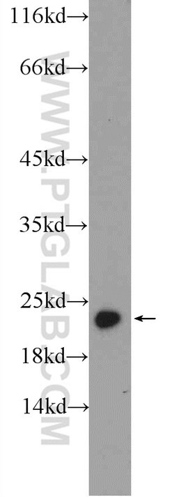 PRDX1 Rabbit anti-Human, Mouse, Rat, Polyclonal, Proteintech 150 &mu;L;