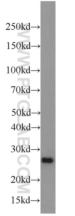 PRDX1 Rabbit anti-Human, Mouse, Rat, Polyclonal, Proteintech 150 &mu;L;