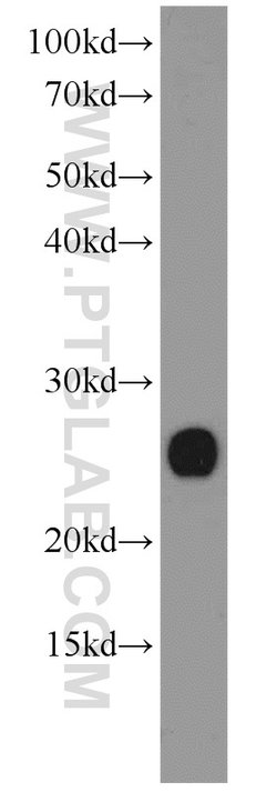 PRDX1 Rabbit anti-Human, Mouse, Rat, Polyclonal, Proteintech 150 &mu;L;