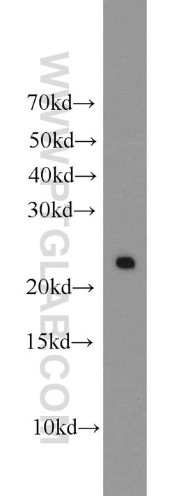 PRDX1 Rabbit anti-Human, Mouse, Rat, Polyclonal, Proteintech 150 &mu;L;