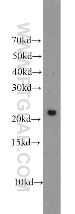 PRDX1 Rabbit anti-Human, Mouse, Rat, Polyclonal, Proteintech 150 &mu;L;
