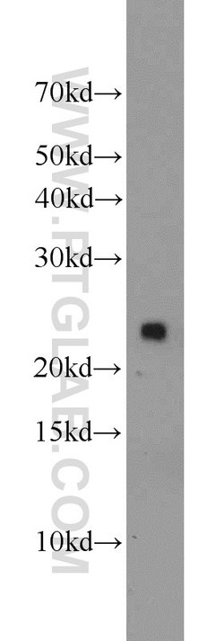 PRDX1 Rabbit anti-Human, Mouse, Rat, Polyclonal, Proteintech 150 &mu;L;