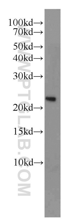 PRDX1 Rabbit anti-Human, Mouse, Rat, Polyclonal, Proteintech 150 &mu;L;