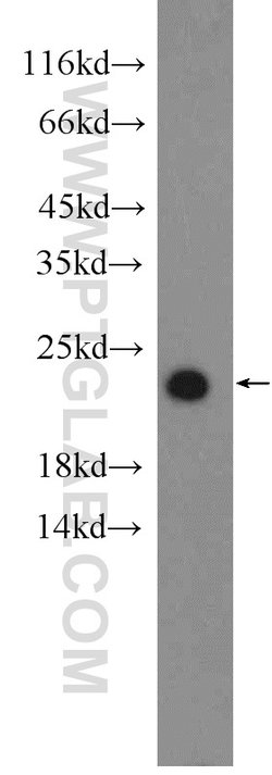 PRDX1 Rabbit anti-Human, Mouse, Rat, Polyclonal, Proteintech 150 &mu;L;