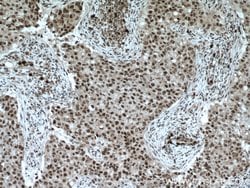 XRCC4 Rabbit anti-Human, Rat, Polyclonal, Proteintech 150 &mu;L; Unconjugated:Antibodies,